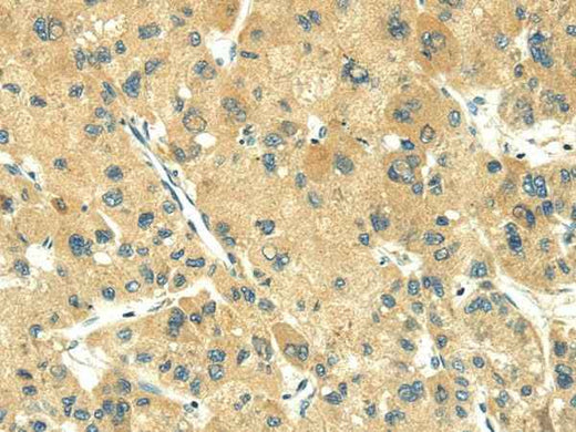 Anti-Human TRIM10 Antibody