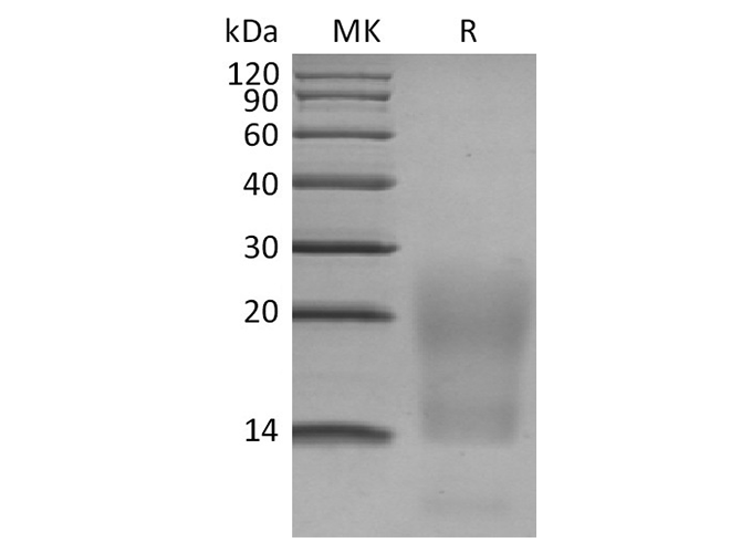 Recombinant Human BCMA/TNFRSF17 Protein (His Tag) - ABMIUM