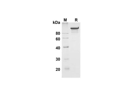 SDS-PAGE analysis of Human MMP-9 proteins , 2 μg/lane of Recombinant Human MMP-9 proteins was resolved with SDS-PAGE under reducing conditions , showing bands at 100-110 kDa.
