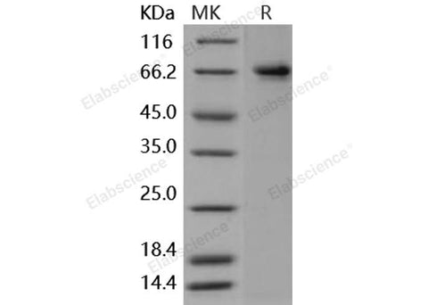 Recombinant Human PTGS2/COX2/PGHS-2 Protein (His Tag) - ABMIUM