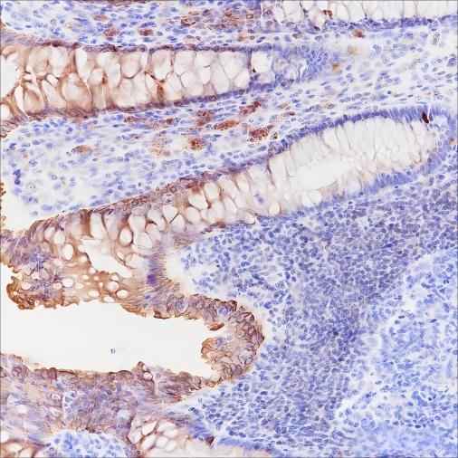 Anti-Human c-erbB-3/HER-3 Antibody [A215] - ABMIUM