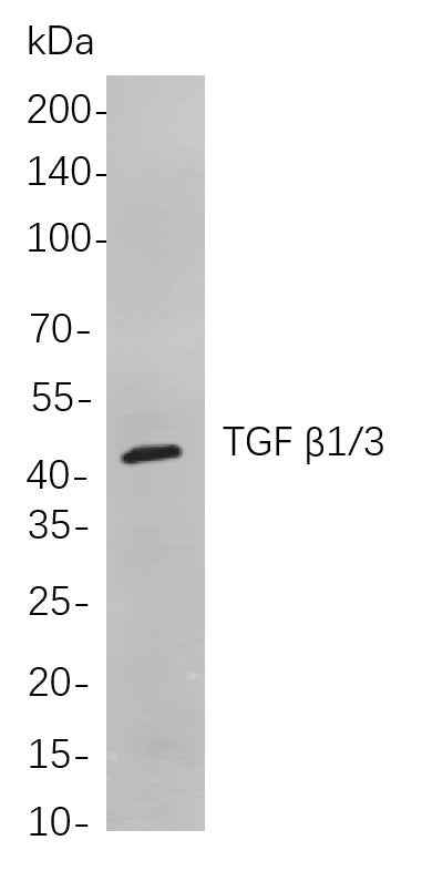 Anti-Human/Mouse/Rat TGF β1/3 Antibody [B884] - ABMIUM
