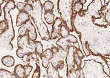Anti-Human GH1 Antibody [A1166] - ABMIUM