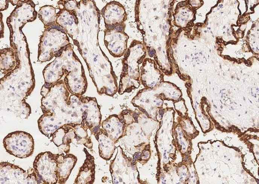 Anti-Human GH1 Antibody [A1166] - ABMIUM