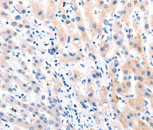 Anti-Human/Mouse/Rat MTOR Antibody