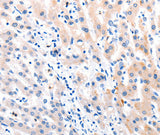 Anti-Human/Mouse/Rat MTOR Antibody - ABMIUM