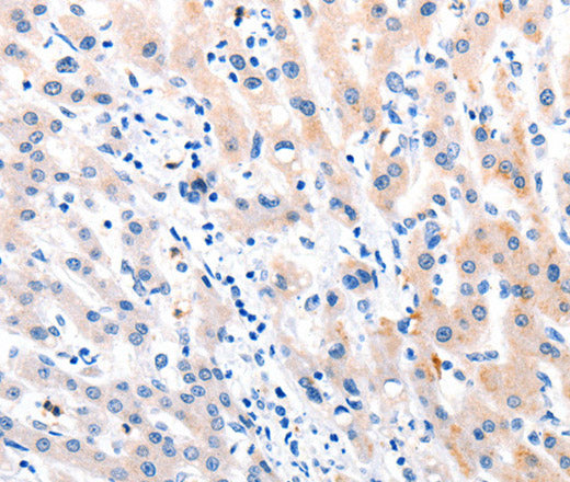 Anti-Human/Mouse/Rat MTOR Antibody - ABMIUM