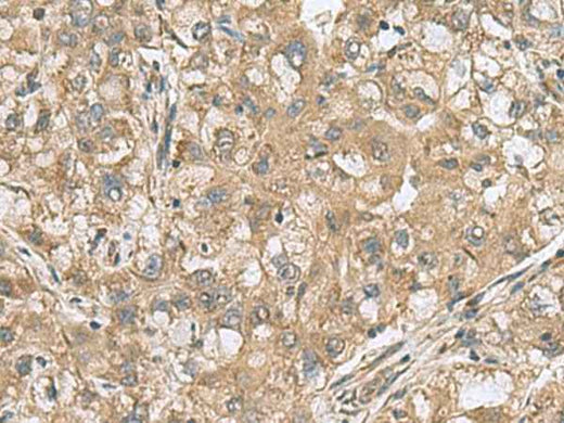 Anti-Human/Mouse PAPSS2 Antibody