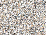 Immunohistochemistry of paraffin-embedded Human tonsil tissue using PTPRS Polyclonal Antibody at dilution of 1:110(×200)