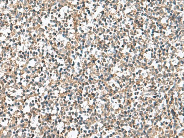 Immunohistochemistry of paraffin-embedded Human tonsil tissue using PTPRS Polyclonal Antibody at dilution of 1:110(×200)