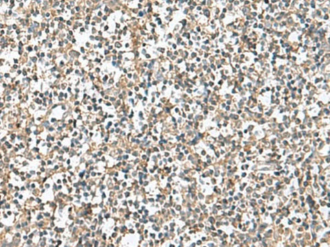 Immunohistochemistry of paraffin-embedded Human tonsil tissue using PTPRS Polyclonal Antibody at dilution of 1:110(×200)