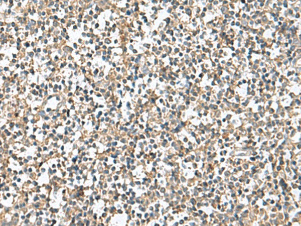 Immunohistochemistry of paraffin-embedded Human tonsil tissue using PTPRS Polyclonal Antibody at dilution of 1:110(×200)