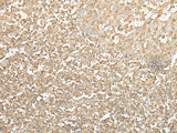Immunohistochemistry of paraffin-embedded Human tonsil tissue using SPIC Polyclonal Antibody at dilution of 1:55(×200)