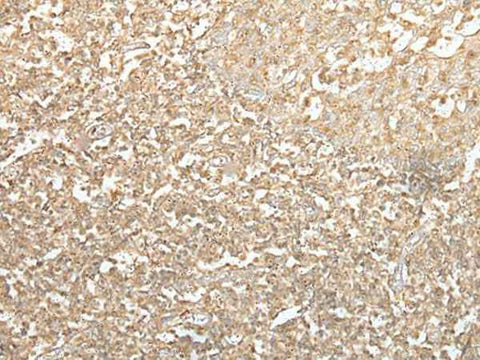Immunohistochemistry of paraffin-embedded Human tonsil tissue using SPIC Polyclonal Antibody at dilution of 1:55(×200)