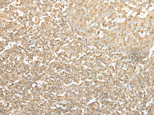 Immunohistochemistry of paraffin-embedded Human tonsil tissue using SPIC Polyclonal Antibody at dilution of 1:55(×200)
