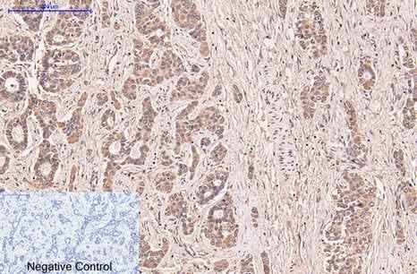 Anti-Human/Mouse/Rat CD5 Antibody [6B1]