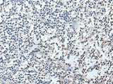 Immunohistochemistry of paraffin-embedded Human tonsil tissue using RERG Polyclonal Antibody at dilution of 1:50(×200)