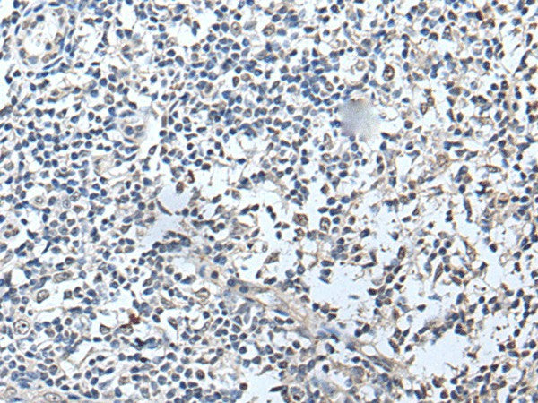 Immunohistochemistry of paraffin-embedded Human tonsil tissue using RERG Polyclonal Antibody at dilution of 1:50(×200)
