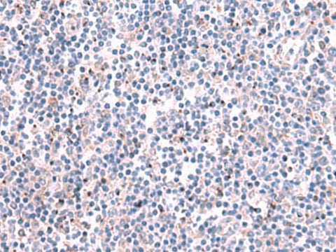 Immunohistochemistry of paraffin-embedded Human tonsil tissue using KCNK10 Polyclonal Antibody at dilution of 1:35(×200)