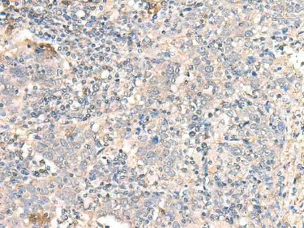 Anti-Human/Mouse/Rat PARS2 Antibody