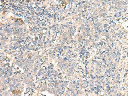 Anti-Human/Mouse/Rat PARS2 Antibody
