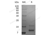 Recombinant Human IGF-1/IGF1 Protein (aa 52-118) - ABMIUM