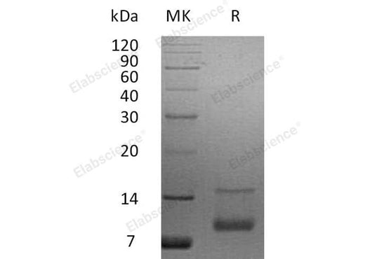 Recombinant Human IGF-1/IGF1 Protein (aa 52-118) - ABMIUM