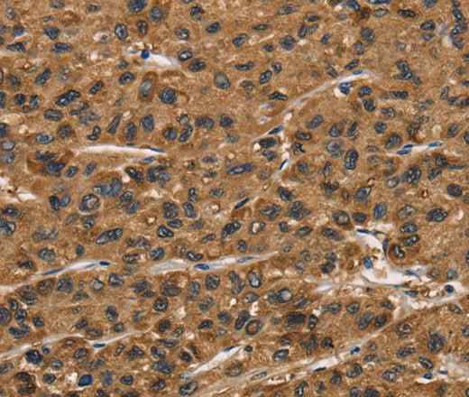 Anti-Human/Mouse/Rat ATP7A Antibody