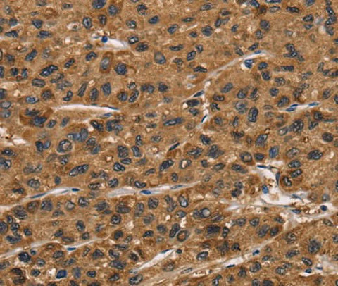 Anti-Human/Mouse/Rat ATP7A Antibody - ABMIUM
