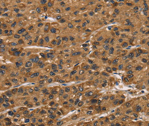 Anti-Human/Mouse/Rat ATP7A Antibody - ABMIUM