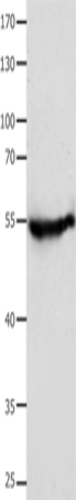 Anti-Human/Mouse/Rat CAP2 Antibody - ABMIUM