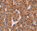 Anti-Human/Mouse CARD11 Antibody - ABMIUM
