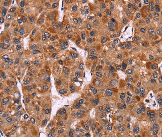 Anti-Human/Mouse CARD11 Antibody - ABMIUM
