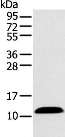 Western blot analysis of Human plasma solution using PPBP Polyclonal Antibody at dilution of 1:500