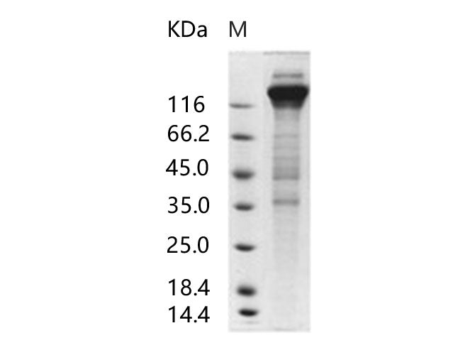 Recombinant Human cytomegalovirus (HCMV) Glycoprotein B / gB Protein (Fc Tag) - ABMIUM