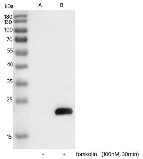 Anti-Human Bad Antibody [A1264] - ABMIUM