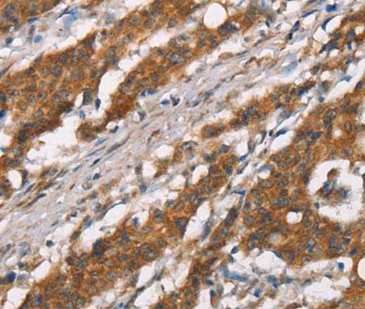 Anti-Human DSC2 Antibody