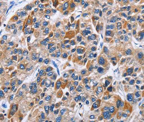 Anti-Human/Mouse/Rat ENPP5 Antibody
