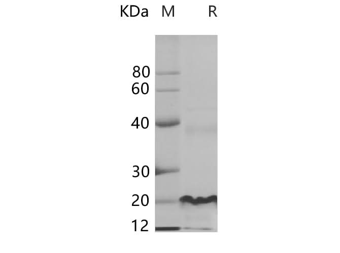SDS-PAGE analysis of Human EGFR proteins, 2 μg/lane of Recombinant Human EGFR proteins was resolved with SDS-PAGE under reducing conditions, showing bands at 20.5 kDa.