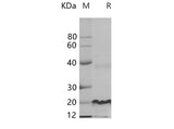 SDS-PAGE analysis of Human EGFR proteins, 2 μg/lane of Recombinant Human EGFR proteins was resolved with SDS-PAGE under reducing conditions, showing bands at 20.5 kDa.
