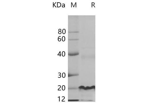 SDS-PAGE analysis of Human EGFR proteins, 2 μg/lane of Recombinant Human EGFR proteins was resolved with SDS-PAGE under reducing conditions, showing bands at 20.5 kDa.