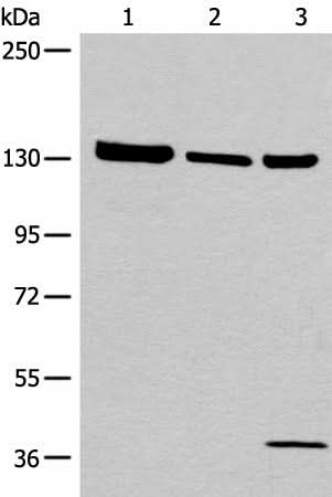 Anti-Human/Mouse/Rat EPHA6 Antibody - ABMIUM