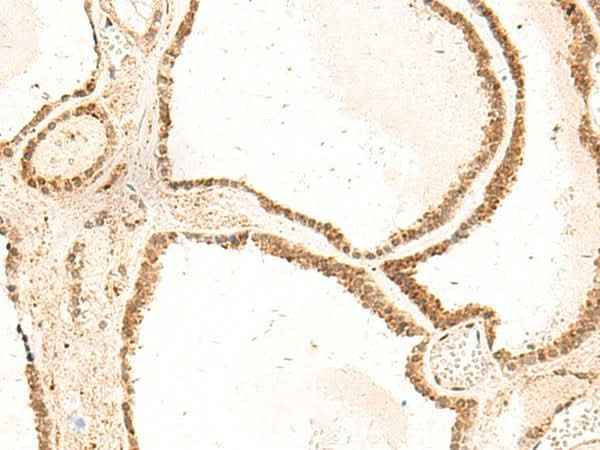 Anti-Human/Mouse/Rat ZFYVE27 Antibody