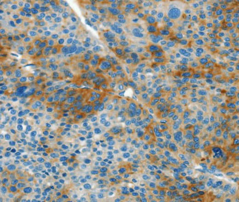 Anti-Human/Mouse/Rat L1CAM Antibody - ABMIUM