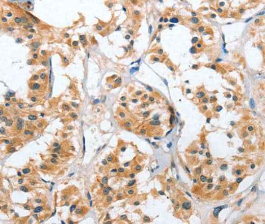 Anti-Human/Mouse/Rat UGCG Antibody