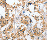 Anti-Human/Mouse/Rat UGCG Antibody - ABMIUM