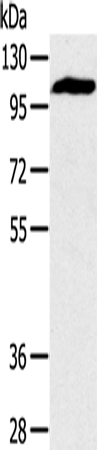 Anti-Human/Mouse/Rat PYGM Antibody - ABMIUM