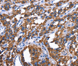Anti-Human/Mouse GREB1 Antibody - ABMIUM