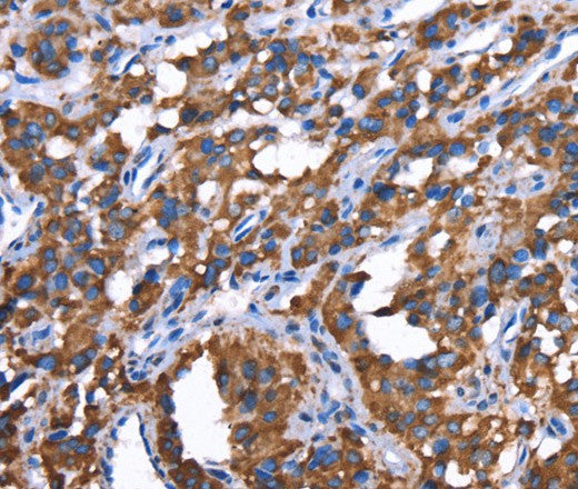 Anti-Human/Mouse GREB1 Antibody - ABMIUM