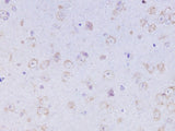 Anti-Mouse/Rat OXA Antibody - ABMIUM